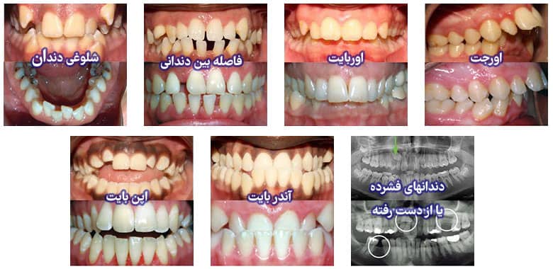 انواع مختلف ناهنجاری های دهان و دندان