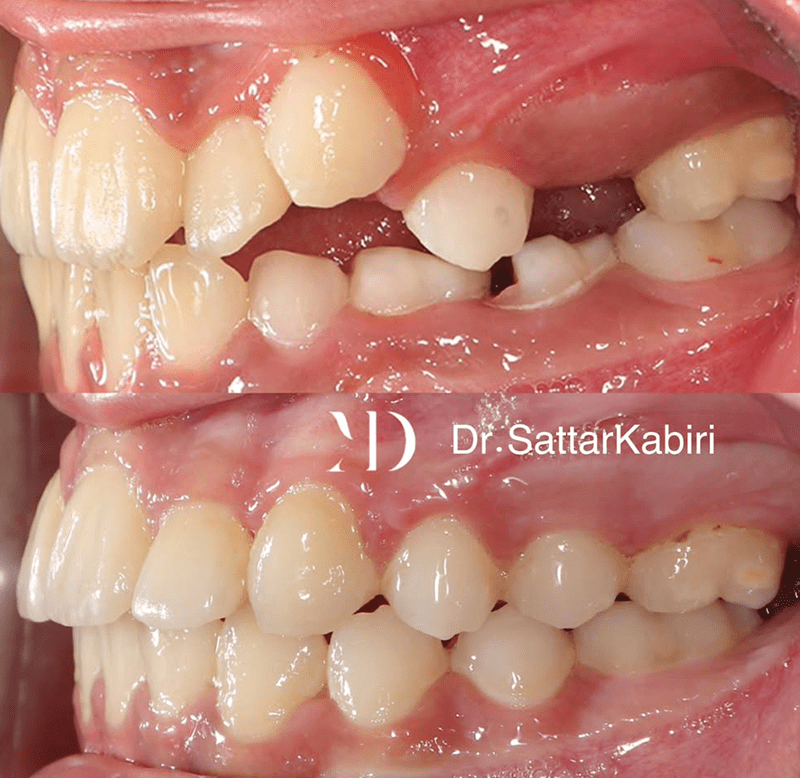 ارتودنسی کودکان