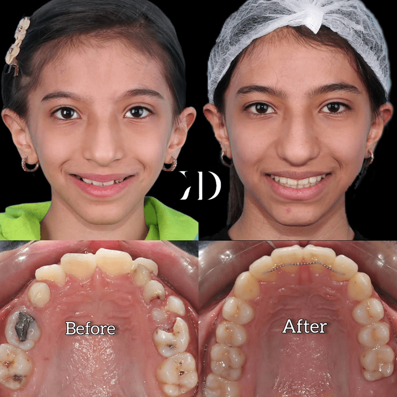 ارتودنسی کودکان