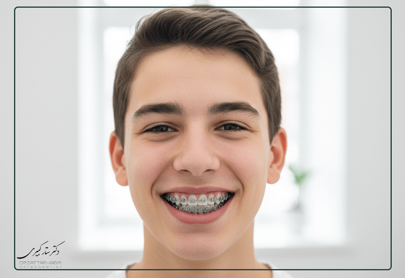 ارتودنسی ثابت دندان