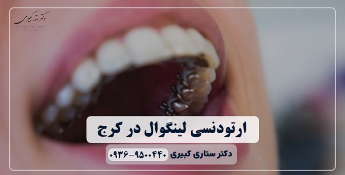 ارتودنسی لینگوال در کرج