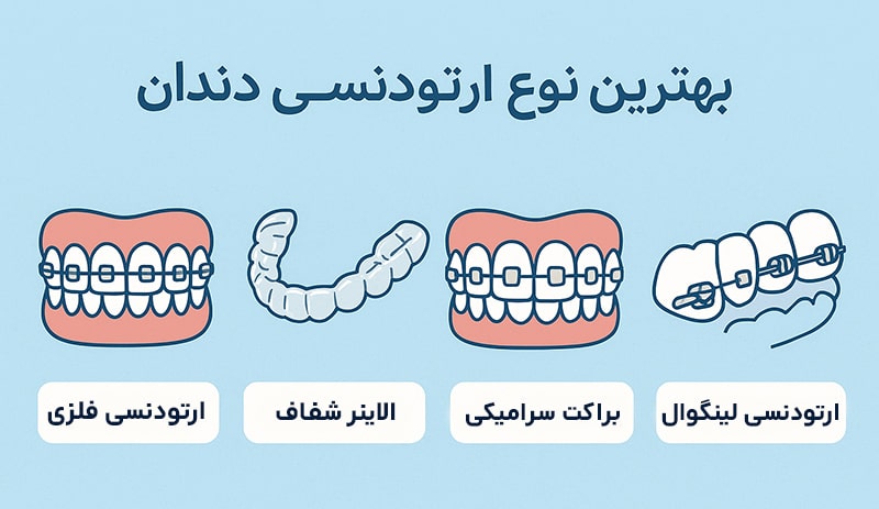 کدام نوع ارتودنسی بهتر است