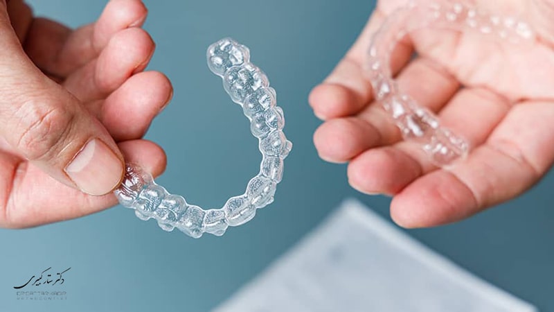 الاینر شفاف ارتودنسی دندان