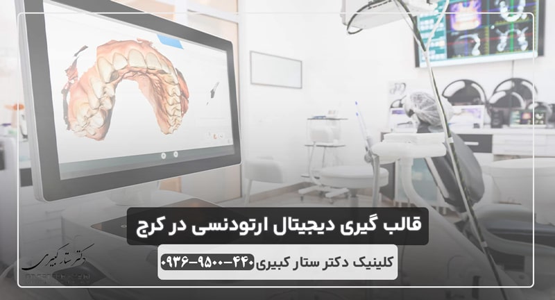 قالب گیری دیجیتال دندان در کرج