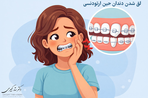 لق شدن دندان حین درمان ارتودنسی