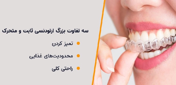 ارتودنسی ثابت یا متحرک
