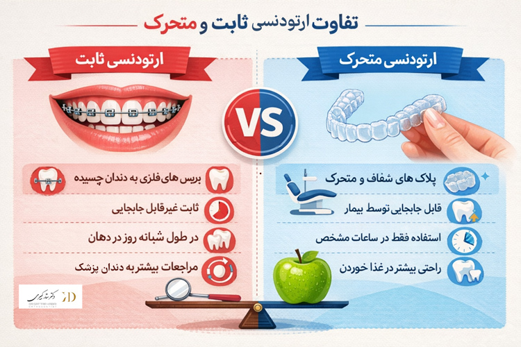 ارتودنسی ثابت بهتره یا متحرک