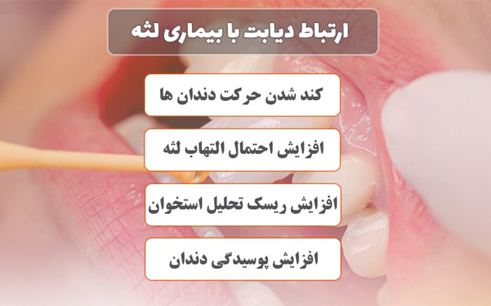 ارتباط دیابت با بیماری لثه