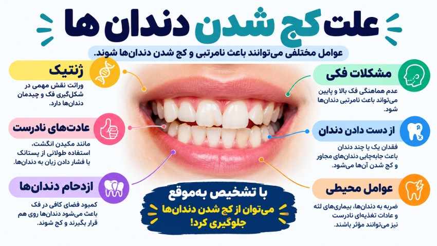 علت کج شدن دندان ها