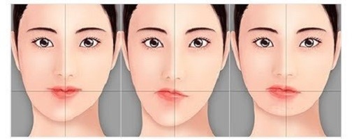 درمان انحراف فک با ارتودنسی