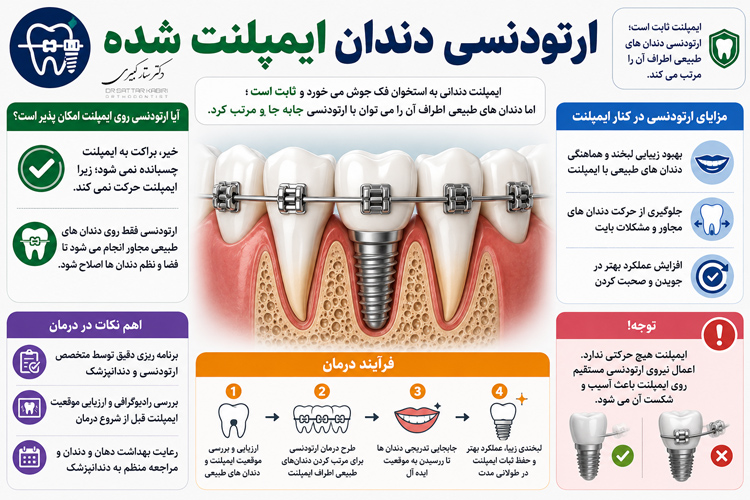 ارتودنسی دندان ایمپلنت شده