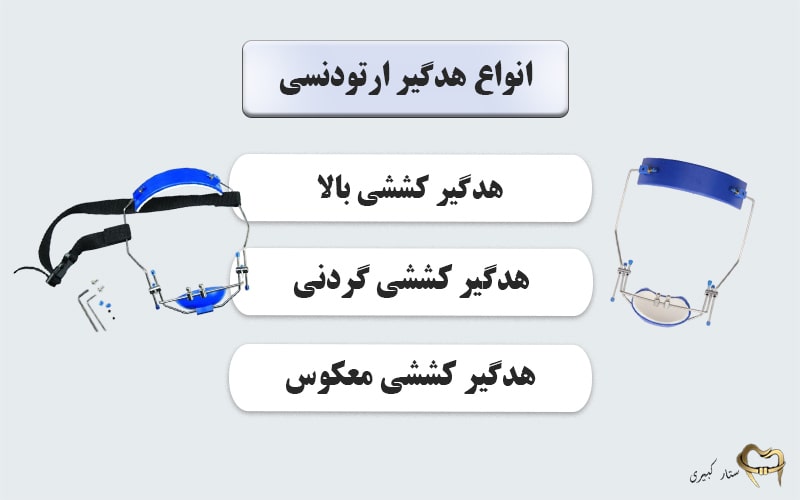 انواع هدگیر ارتودنسی