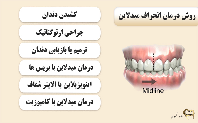 روش های درمان انحراف میدلاین