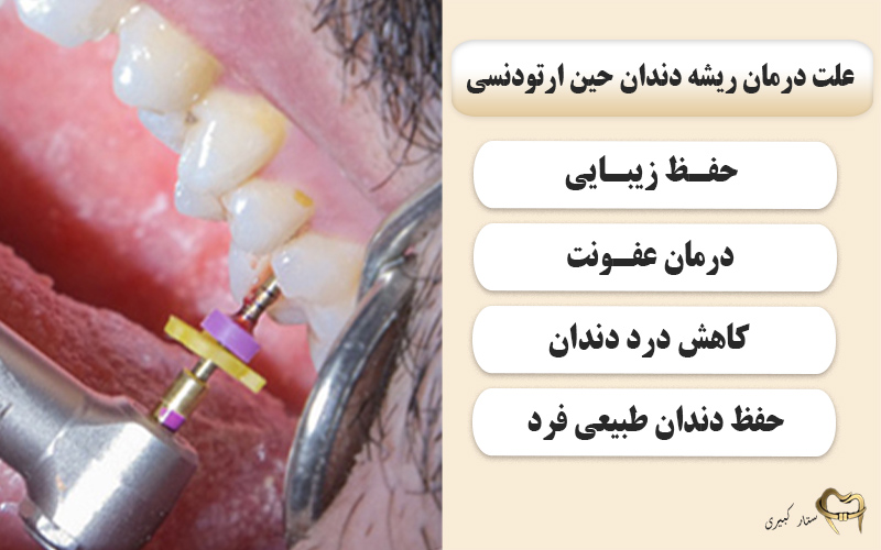 چرا حتی با وجود ارتودنسی باید درمان ریشه دندان را انجام داد؟