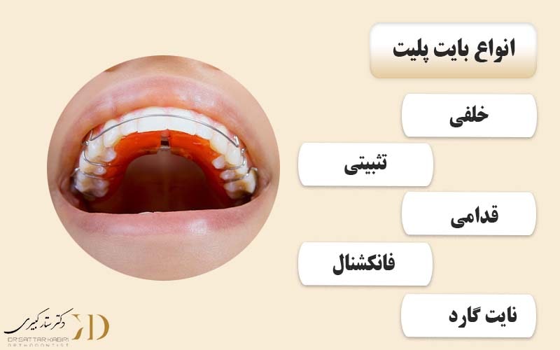 انواع بایت پلیت