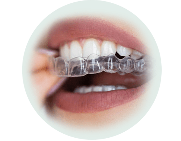 ارتودنسی نامرئی