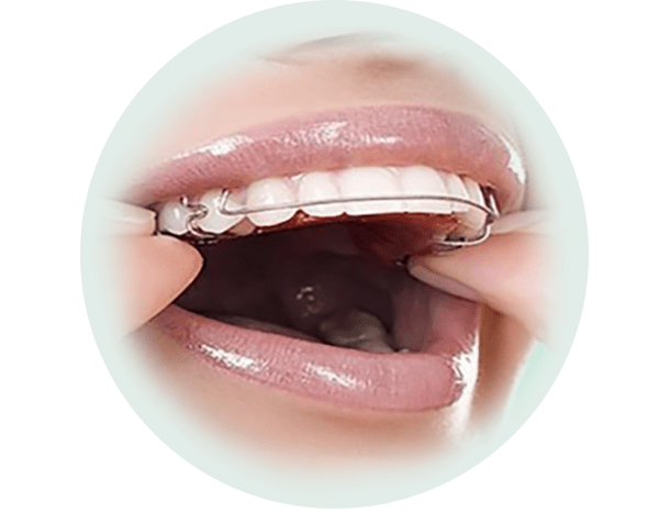 ارتودنسی متحرک