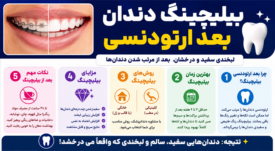 بیلیچینگ بعد از ارتودنسی