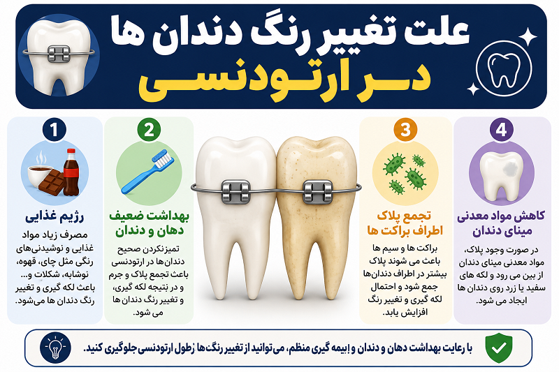 علت تغییر رنگ دندان ها در ارتودنسی