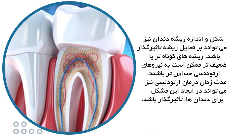 علت تحلیل ریشه دندان در ارتودنسی