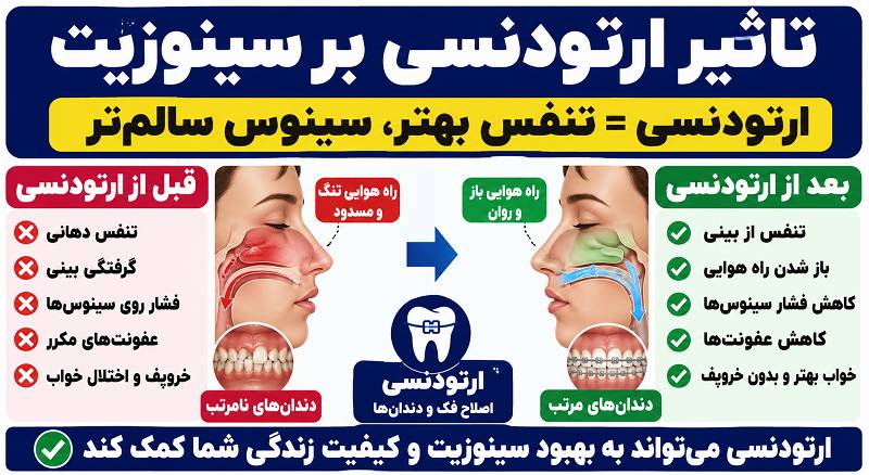 تاثیر ارتودنسی بر سینوزیت