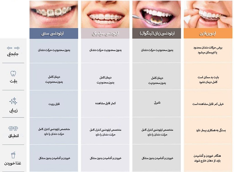مدت درمان با انواع ارتودنسی