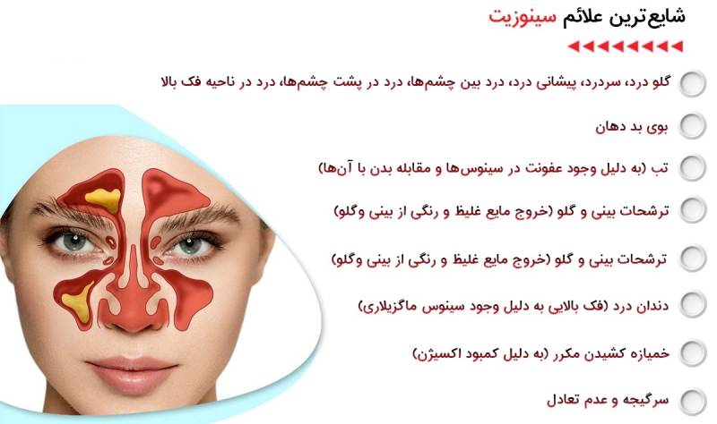 علائم مشکلات سینوسی ناشی از دندان ها