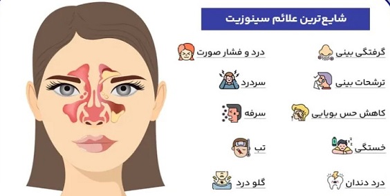 علائم سینوزیت