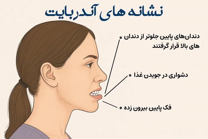 نشانه های آندربایت