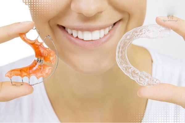 تفاوت ریتینر و الانیر