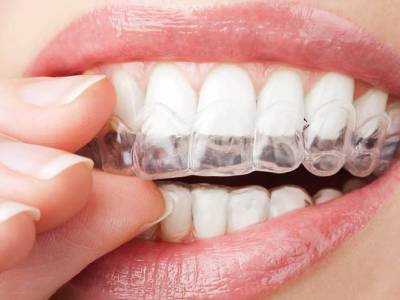 اصلاح اوربایت با الاینر