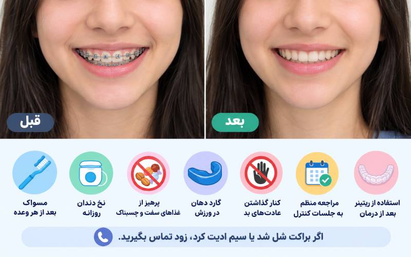 مراقبت های ارتودنسی نوجوانان