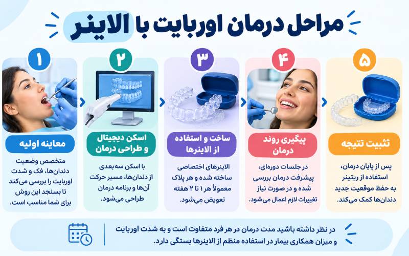 مراحل درمان اوربایت با الاینر
