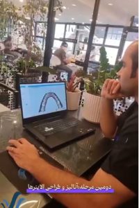 مراحل ارتودنسی دیجیتال