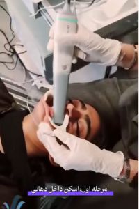 مراحل ارتودنسی دیجیتال