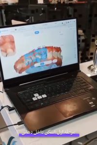 مراحل ارتودنسی