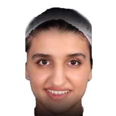 عکس ارتودنسی