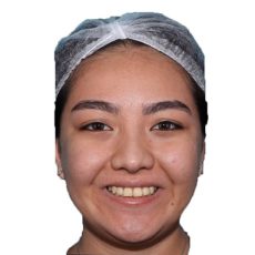 نمونه درمان ارتودنسی